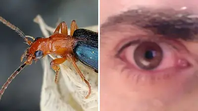 Cómo evitar encontrarse con el insecto preligroso que puede dejarte ciego. Cómo evitar encontrarse con el insecto preligroso que puede dejarte ciego.