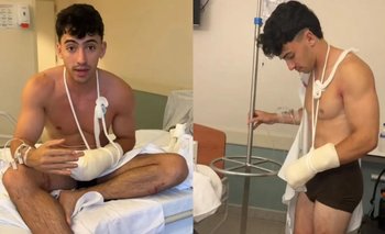 Quién es Gero Arias, el influencer que perdió dos dedos: qué le pasó | Redes sociales