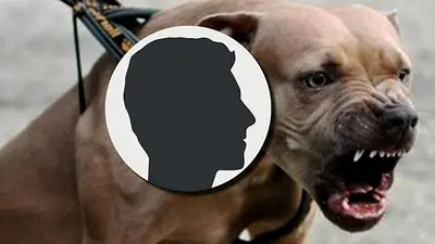 Perro muerde a famoso argentino y así lo dejó. Perro muerde a famoso argentino y así lo dejó.
