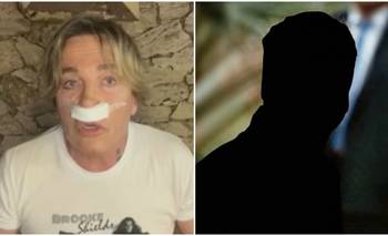 Guido Suller se operó la cara para parecerse a un actor de Hoolywood | Farándula