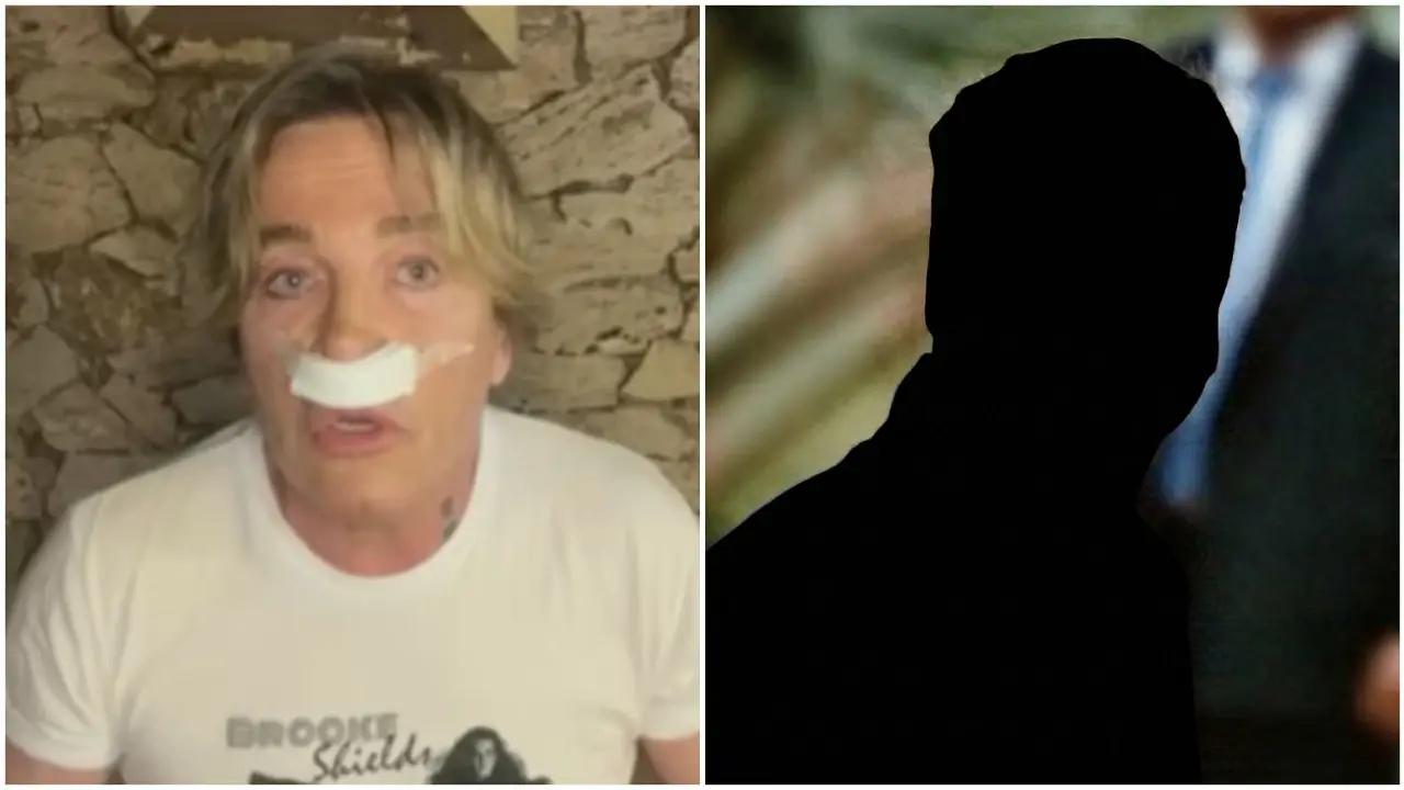 Guido Suller se operó la cara para parecerse a un actor de Hoolywood.
