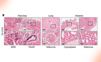 Crean el primer atlas de líneas celulares de cáncer de ratón | Conicet