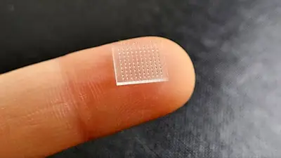 Chau a las biopsias: cómo es el innovador método para monitorear el sistema inmune sin cirugías Chau a las biopsias: cómo es el innovador método para monitorear el sistema inmune sin cirugías