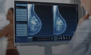 ¿Aumenta el cáncer de mama en las más jóvenes? Hay opiniones divididas | Ciencia 