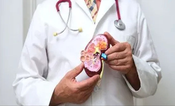 Enfermedad renal: el alarmante porcentaje de argentinos que tiene complicaciones | Salud