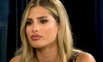 Julieta Poggio sufrió un fuerte accidente: “Está en carne viva” | Televisión 