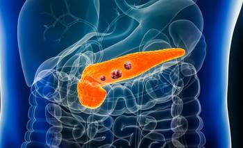 ¿Un paso hacia la cura? Científicos eliminaron el cáncer de páncreas en ratones | Salud