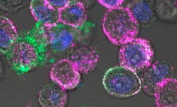 Una empresa de EE.UU. adquirió virus diseñados en Argentina para “cazar” tumores | Ciencia 