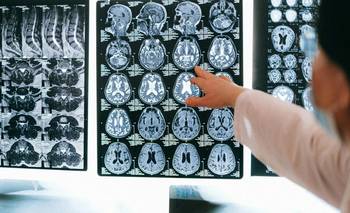 Superancianos: el secreto de su memoria excepcional según la ciencia | Salud