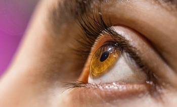 Shock por el color de ojos más raro del mundo | Ojos