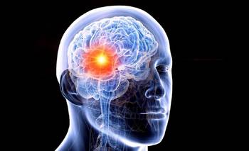 Epilepsia en Argentina: mitos, estigma y tratamiento adecuado | Salud