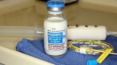 Qué es el propofol, la droga que habría usado un anestesista acusado de ofrecer "viajes controlados" Qué es el propofol, la droga que habría usado un anestesista acusado de ofrecer "viajes controlados"