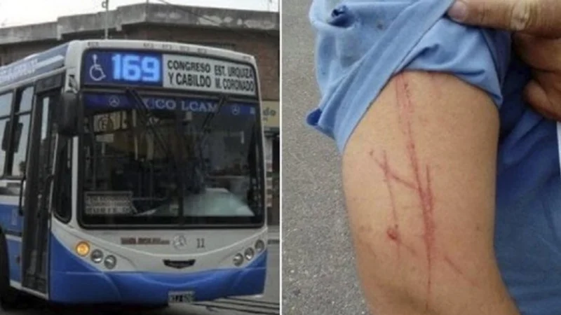 Atacaron a otro colectivero en Pablo Podestá