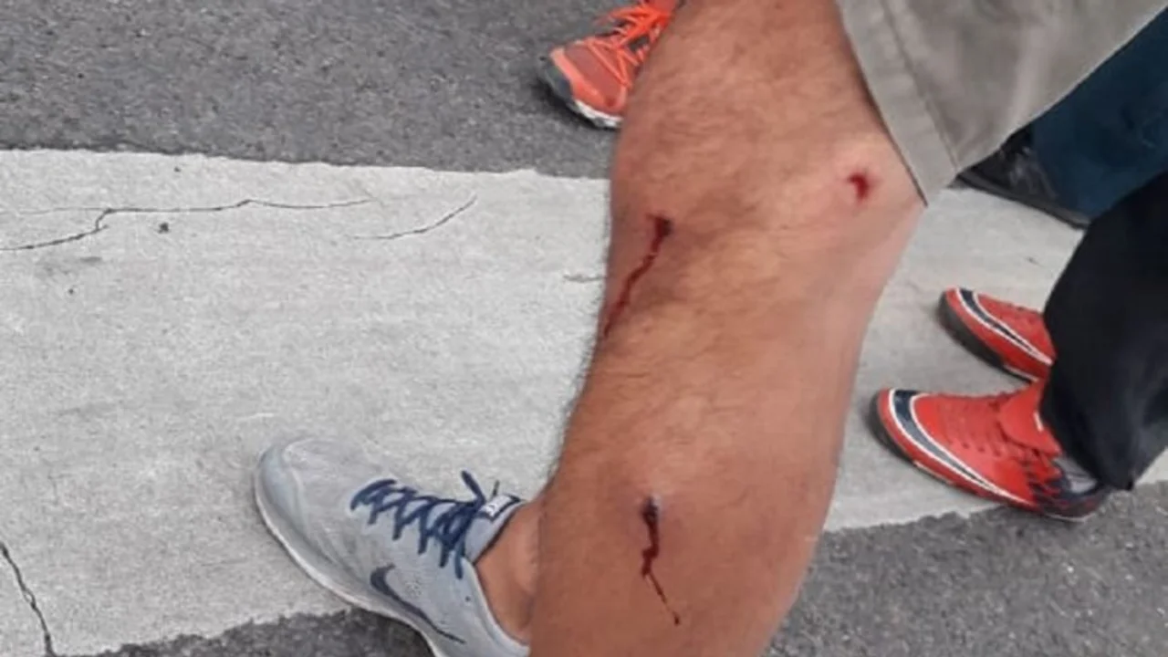La Policía de Larreta golpeó a manifestantes en el Ministerio de Desarrollo Social