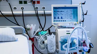 No podrán venderse respiradores artificiales sin autorización del Ministerio de Salud No podrán venderse respiradores artificiales sin autorización del Ministerio de Salud
