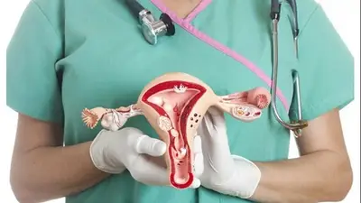 Salud, enfermedades, vacuna, cáncer de útero Salud, enfermedades, vacuna, cáncer de útero