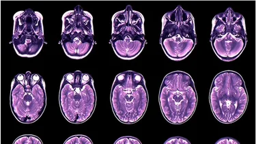 El estudio que muestra cómo se expande y se encoge el cerebro en la vida