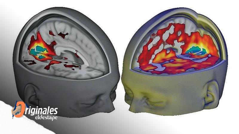 Las drogas psicodélicas podrían ayudar a enfrentar la depresión