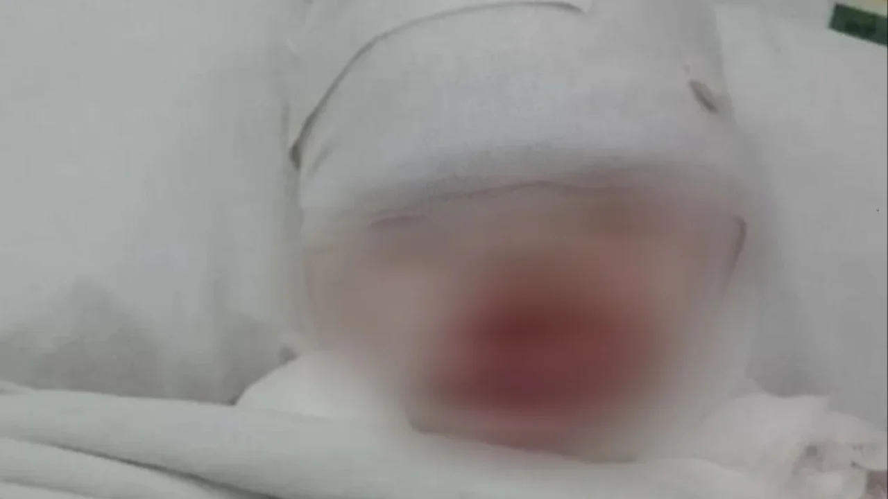Por error, le volcaron aceite hirviendo a una niña de tres años en un restaurant de Florencio Varela