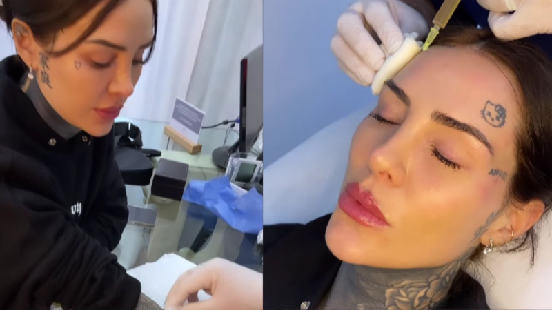 Cande Tinelli y un nuevo tratamiento estético.