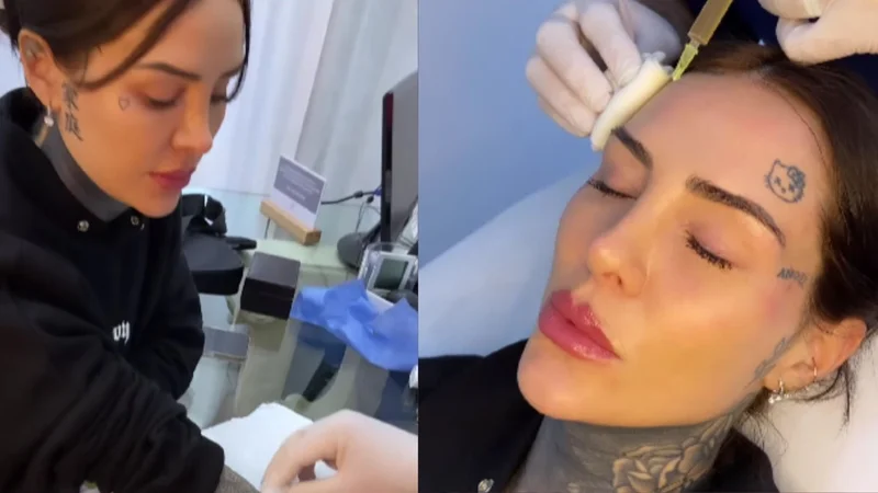 Cande Tinelli y un nuevo tratamiento estético.