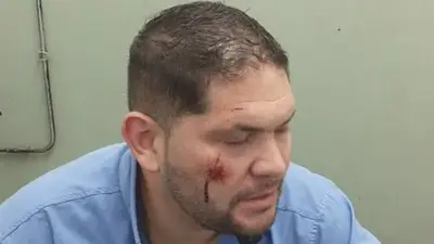 chofer de Moreno asaltado chofer de Moreno asaltado