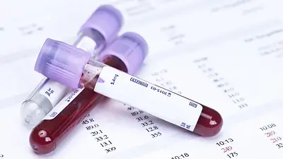 Análisis de sangre Análisis de sangre