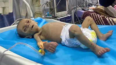 Jefe de la UNRWA alerta que la hambruna se está extendiendo en Gaza Jefe de la UNRWA alerta que la hambruna se está extendiendo en Gaza