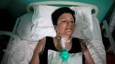 Peruana accede a la eutanasia tras larga batalla legal por su derecho a elegir "muerte digna" Peruana accede a la eutanasia tras larga batalla legal por su derecho a elegir "muerte digna"