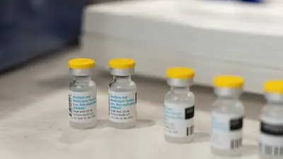 La República del Congo declara la epidemia de mpox La República del Congo declara la epidemia de mpox