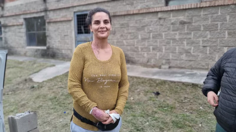 Córdoba: Pamela Cano sobrevivió al intento de femicidio con ácido de su ex y ya está de alta