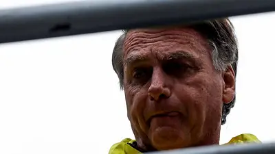 Brasil: operan a Bolsonaro tras un fuerte dolor abdominal Brasil: operan a Bolsonaro tras un fuerte dolor abdominal