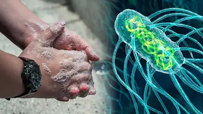 Alerta en el AMBA: confirman 10 casos de fiebre tifoidea Alerta en el AMBA: confirman 10 casos de fiebre tifoidea