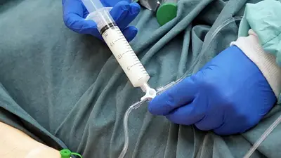 Cuáles son los efectos del propofol y el fentanilo, las drogas utilizadas en las "fiestas controladas" de los anestesistas del Hospital Italiano Cuáles son los efectos del propofol y el fentanilo, las drogas utilizadas en las "fiestas controladas" de los anestesistas del Hospital Italiano