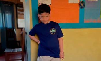 Bastián fue operado de nuevo y su madre envió un mensaje: "Un poquito más" | Accidente