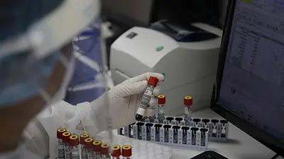 Análisis de sangre. Análisis de sangre.