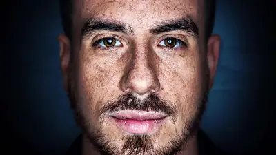 El radical cambio de look de Fede Bal en su lucha contra el cáncer El radical cambio de look de Fede Bal en su lucha contra el cáncer