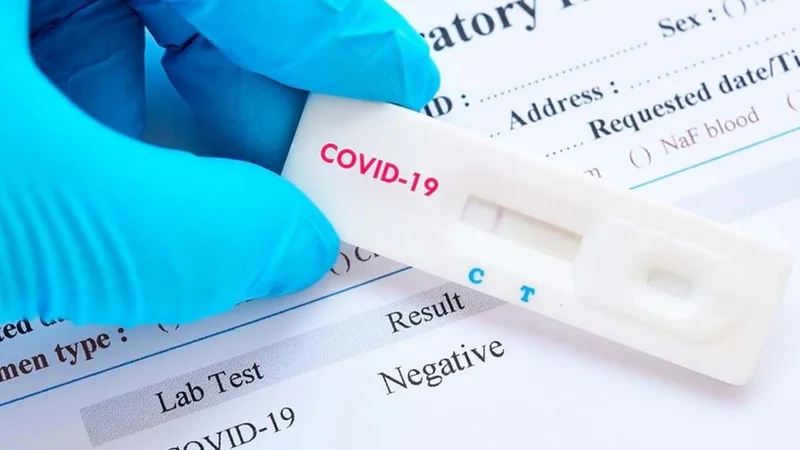 Provincia prohibió la venta de test rápidos en farmacias
