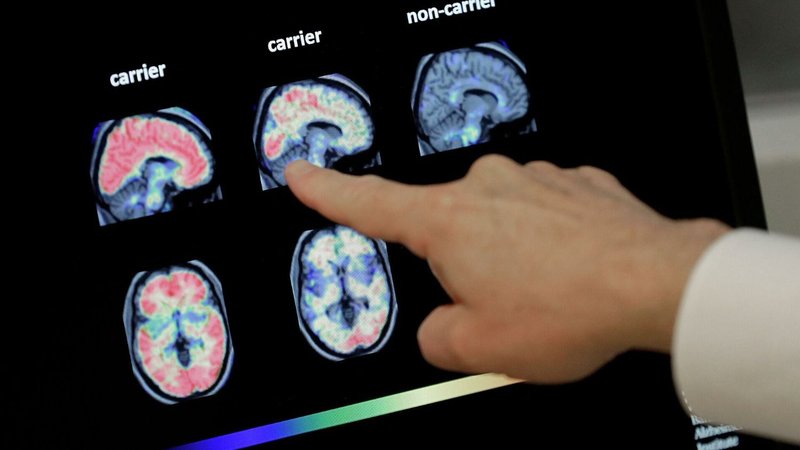 El importante hallazgo de investigadores argentinos sobre las regiones del cerebro y la memoria episódica