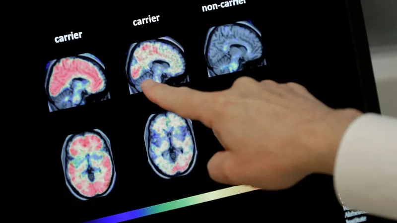 El importante hallazgo de investigadores argentinos sobre las regiones del cerebro y la memoria episódica