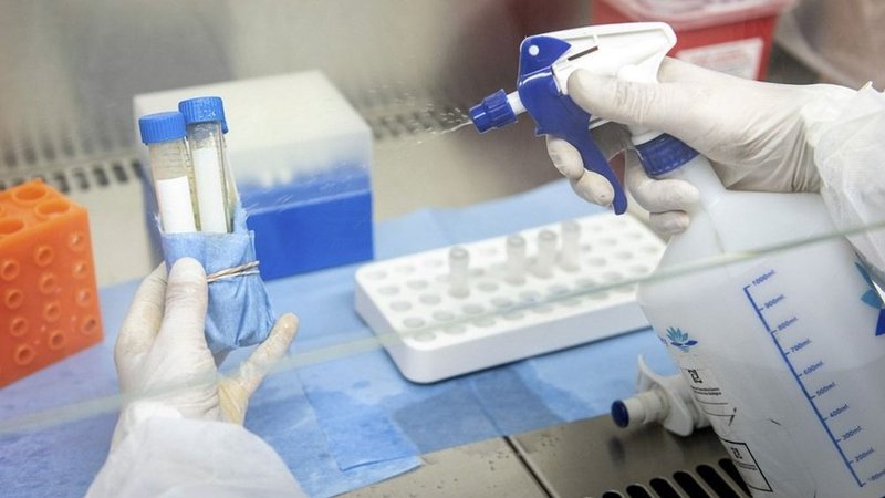 ANMAT aprobó un nuevo método más seguro para la manipulación de muestras de COVID-19