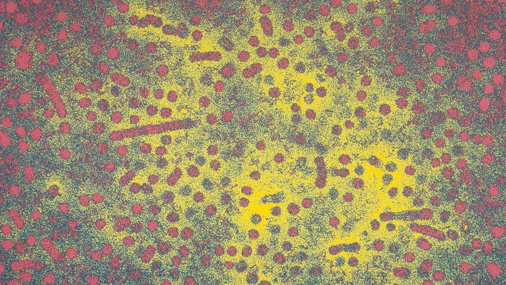 Noticias de Hepatitis aguda grave - El Destape