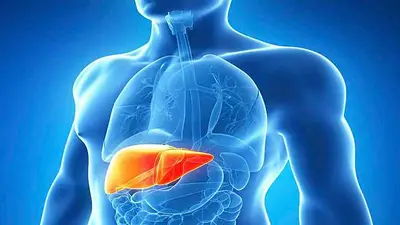 Hepatitis aguda grave Hepatitis aguda grave