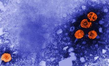 Alarma por hepatitis A: aumento de casos y Argentina ya está en "zona de alerta" | Salud