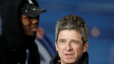 Noel Gallagher recibe varios puntos tras sufrir un cabezazo en celebración del Manchester City Noel Gallagher recibe varios puntos tras sufrir un cabezazo en celebración del Manchester City