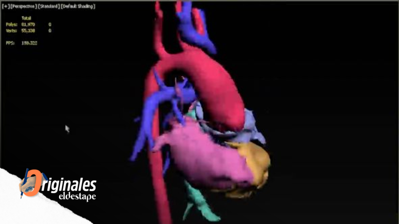 Desarrollaron un sistema en 3D único en América Latina para planear cirugías complejas en forma virtual