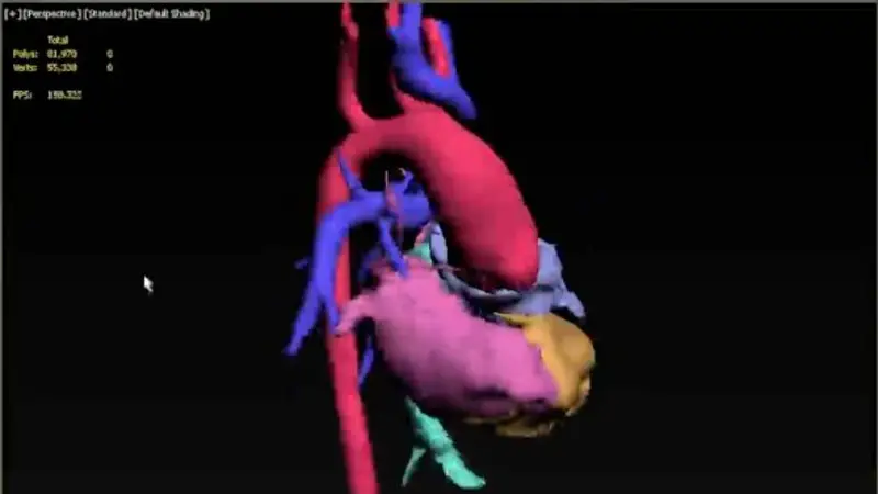 Desarrollaron un sistema en 3D único en América Latina para planear cirugías complejas en forma virtual