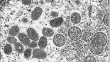La amenaza de los virus 