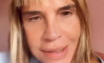 Fabiana Cantilo habló de su problema de salud y contó que pospuso un show | Música