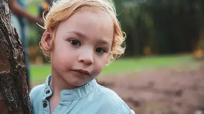 Niño con Síndrome de Cri Du Chat Niño con Síndrome de Cri Du Chat